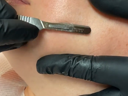Collection image for: DERMAPLANING