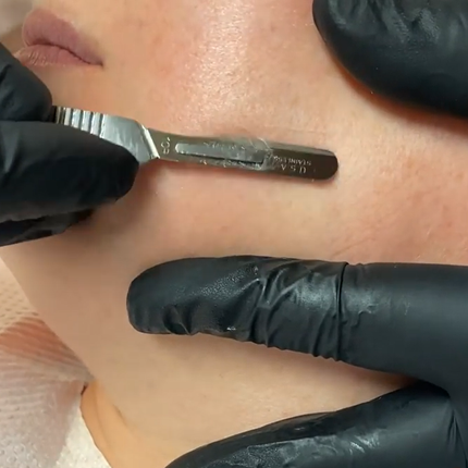 Collection image for: Dermaplaning